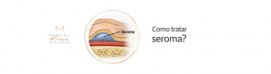 Seroma tem tratamento?